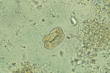 De vrouwtjes zijn, naargelang de auteur, parthenogenetisch, hermafrodiet of protoandrogonisch (deze laatste zouden tijdens hun ontwikkeling een involutie van de mannelijke organen ondergaan, waardoor