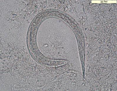 ...8. Diagnose Er is steeds een eosinofilie. Er is geen anemie vermits de parthenogenetische vrouwtjes niet hematofaag zijn.