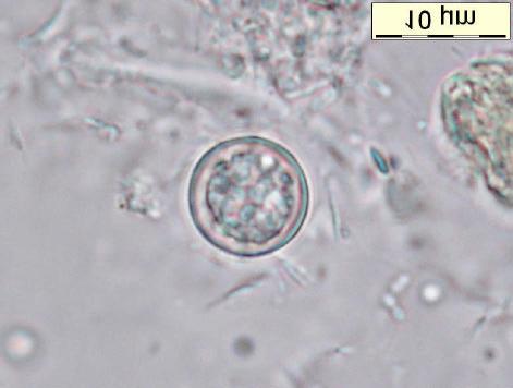 Fig.... Cyclospora cayetanensis (staal