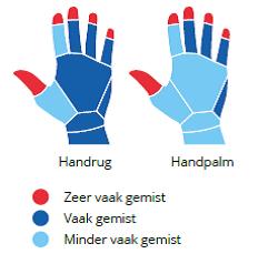 "Een goede handhygiëne is cruciaal om zorginfecties te voorkomen", zegt Pascal De Waegemaeker van het Team Infectiepreventie. "Handhygiëne is dan ook een topprioriteit in het UZ Gent.