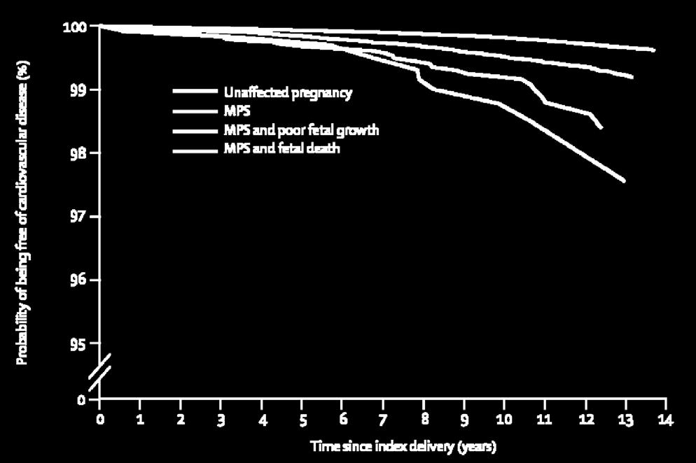 Pre-eclampsie & HVZ Retrospectieve cohort studie 1.033.