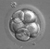 Standaard opties bij mammacarcinoom: spoed IVF/ICSI vóór start adjuvant chemotherapie 1. Invriezen embryo s 2.