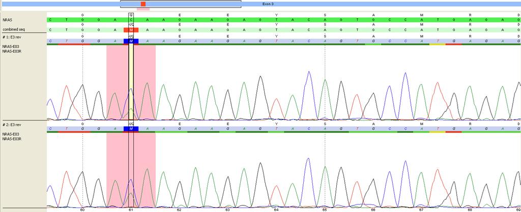 Case 4: T11-14923 I1 NRAS c.181c>a(p.