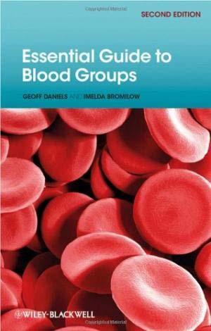 Preventie allo-immunisatie > 300 bloedgroepen idealiter zouden we voor alle bloedgroepen willen matchen om de