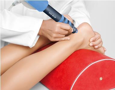 BEHANDELING Conservatief: - Bursitis: Aanpassing irriterend schoeisel Infiltratie