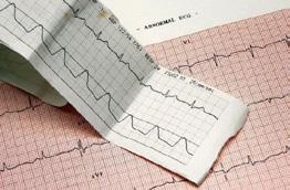 Echo (Echocardiogram) Bij een echo worden met behulp van geluidsgolven afbeeldingen van uw hart gemaakt.