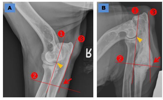 3.3 DE HOEK VAN DE OSTEOTOMIE TEN OPZICHTE VAN DE ULNA Uiteindelijk werd op de direct postoperatieve radiografie werd ook de hoek tussen de osteotomie en de ulna bepaald.