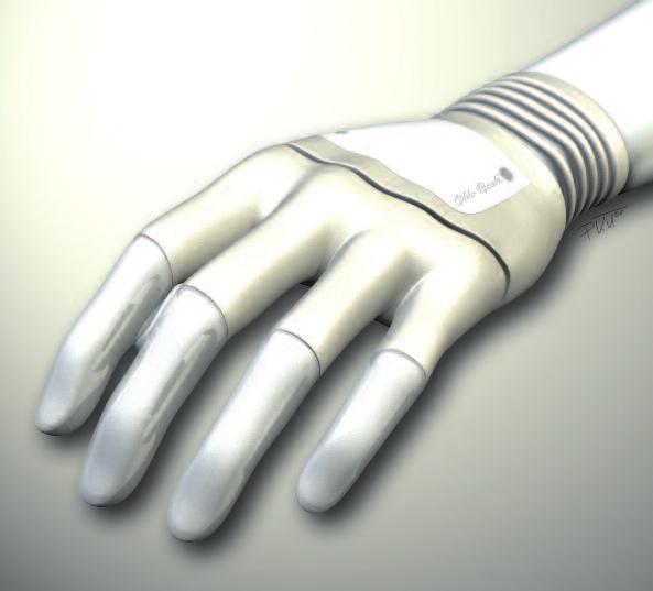 Geavanceerde prothesehanden Bent u benieuwd naar de ontwikkelingen op het gebied van elektrische handen?