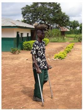 Als de operatiewond een eind opgeknapt is en Joseph met krukken kan lopen, hinkend op zijn goede been wordt er een kunstbeen aangemeten. Er wordt goed gekeken en gemeten hoe groot het moet zijn en zo.