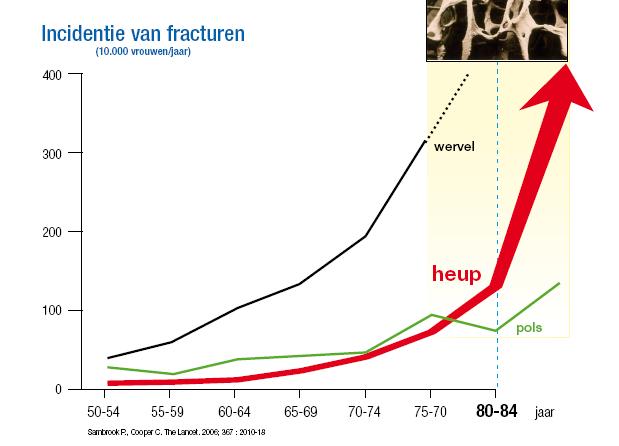 Vanaf 80 jaar stijgt de