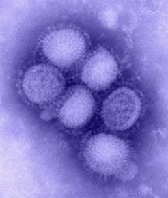 Influenza Mexicaanse griep Wat is het: - acute luchtweg infectie mild De oorzaak: - Nieuwe Influenza A(H1N1) -virus - incubatietijd: 1-4 (max 7) dagen De symptomen: - van asymptomatisch tot 2-7 dagen