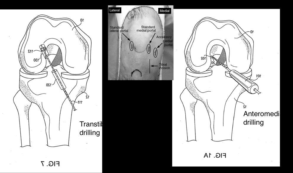 Chirurgie: