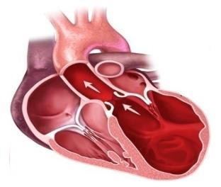 Heart Failure Leading cause of hospitalizations Coexistence of Heart Failure and