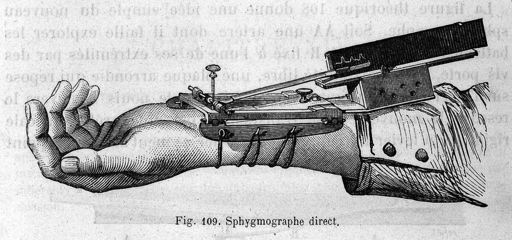 Blutdrucks mit dem Sphygmographen (1898) Buitengewoon