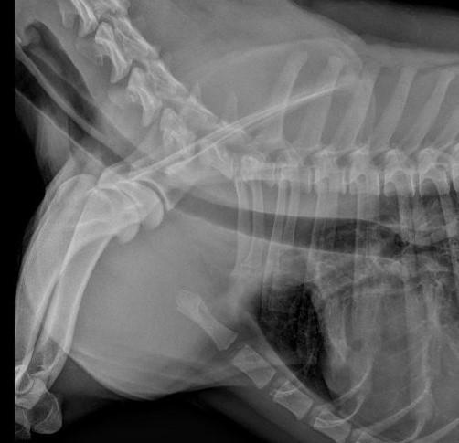 Trachea Carina: thv 4-5e IC Redundant