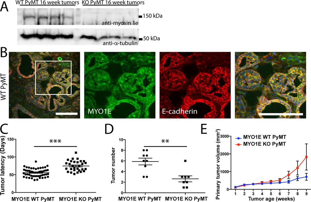 PyMT mice deficient in MYO1E exhibit increased tumor latency but show faster increase in volume compared to the MYO1E WT PyMT controls two distinct cell layers (Figure 1C).