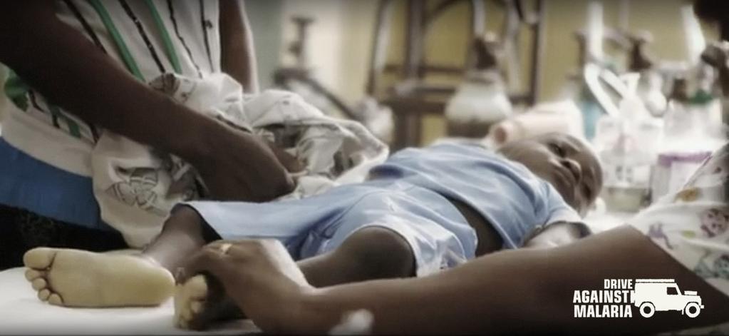 Een klein jongetje is er slecht aan toe - de malariaparasiet heeft de rode bloedcellen aangevallen en de zooltjes van zijn voetjes zijn schrikbarend wit Zij stierf aan malaria Aangezien deze crisis
