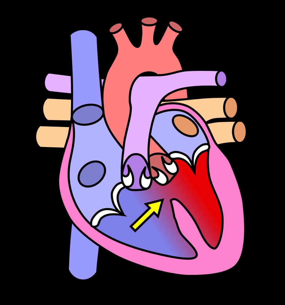 Bij ernstige cardiomyopathie en hartfalen behoort een infuus met carnitine tot de mogelijkheden. Laat u wel goed begeleiden door een arts of therapeut.