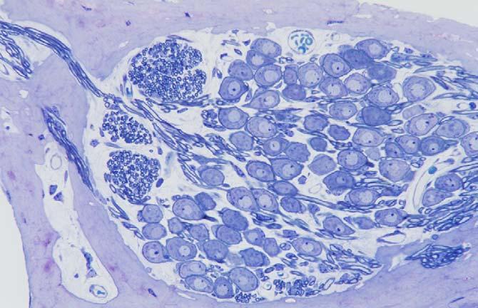 Afgifte van neurotrofe factoren