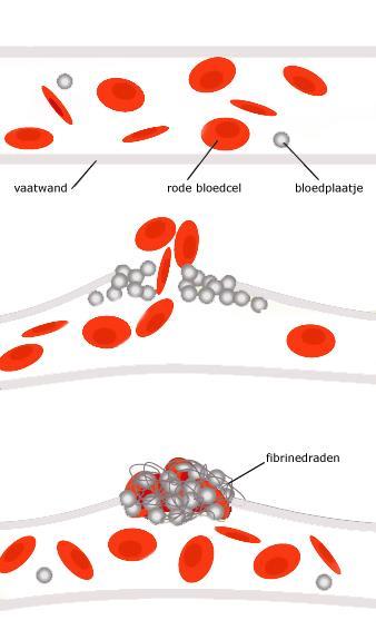 Verloop van de bloedstolling Fase 1 Vorming van stolsel om het bloedverlies te beperken Fase 2 Bloedplaatjes hechten zich aan de kapotte