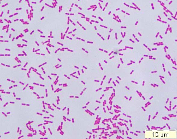 Tabel.. Oriënterende identificatie van de HACEKgroep. Katalase Oxydase Groei op McConkey Actinobacillus Cardiobacterium Eikenella Kingella Haemophilus aphrophilus + 0 0 0 0 V + + + 0 0 0 0 V V Tabel.