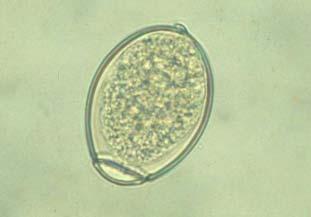 Fig.... Ei ( µm op 00µm) van