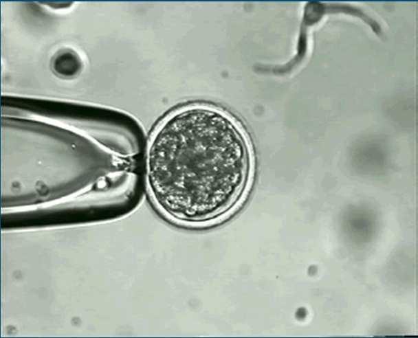 Embryo s Volledige complement chromosomale and mitochondriële genen.