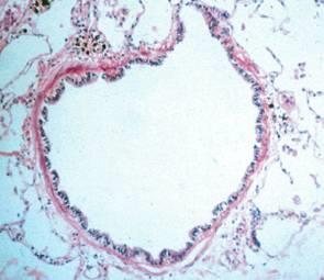 Risicofactoren en Pathogenese