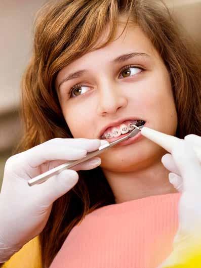 Denta Plus, de tandzorgverzekering van LM Denta Plus komt je tegemoet in de kosten van preventieve en curatieve tandverzorging, parodontologie, orthodontie en prothetische behandelingen en dit