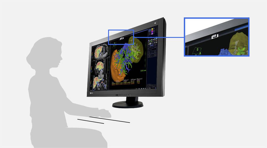 Pro-software (apart verkrijgbaar) Zonder 12-bit-LUT Met 12-bit-LUT Nauwkeurige diagnoses met kleuren- en monochrome opnames Monochrome mammografieopnames en MRI- en echografiebeelden in kleur zijn de