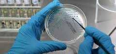 Wat zijn Bijzonder Resistente Micro-Organismen? Bijzonder Resistente Micro-Organismen worden ook wel BRMO genoemd. Deze bacteriën zijn ongevoelig (resistent) voor de standaard antibiotica.