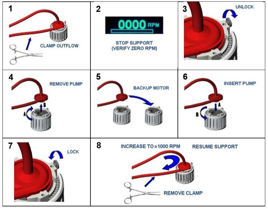Bijlage 2: Huidige instructies voor vervanging van bloedpomp De onderstaande illustratie over correct gebruik van kabels wordt opgenomen in de desbetreffende handleiding van het CentriMag-systeem, en