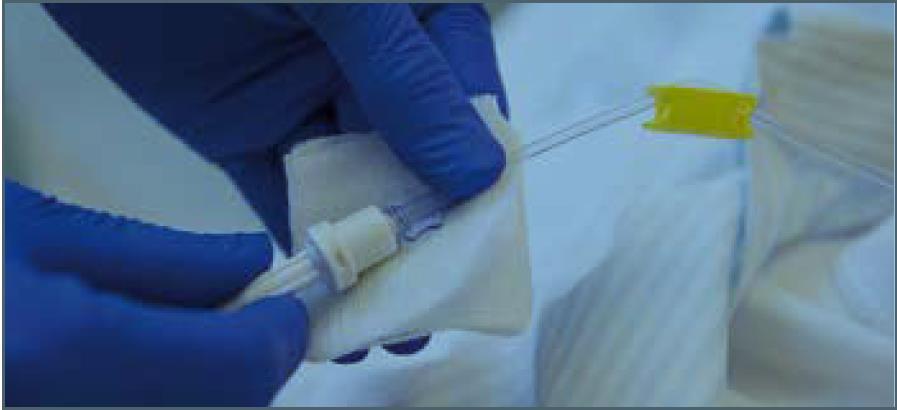 Hou een steriele kompres onder de connectie tussen pomp en katheterleiding. Ontkoppel de leiding van de folfusor pomp en de katheter van elkaar. Sluit de leiding van de folfusor pomp af.