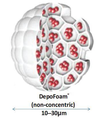 Lipo-bupivacaine: DepoFoam FDA approval for infiltration Depodur (Endo