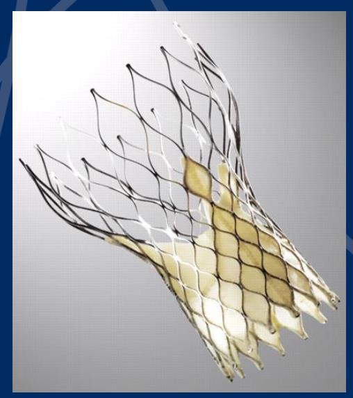 Medtronic Corevalve Self-expandable