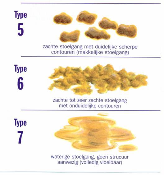 gefragmenteerde stoelgang evacuatie (spontaan, hevig persen, zakkingsgevoel) ophoudgedrag hoeveelheid (gevoel van onvolledige lediging?