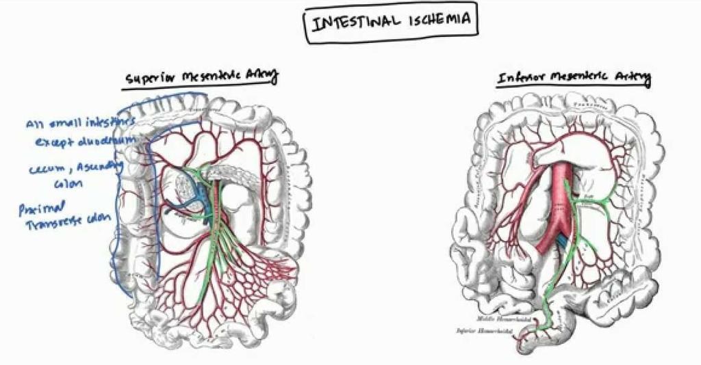 Bloedvoorziening : AMS + AMI + a hemorrhoidalis sup Anatomische kwetsbare regio s = splen hoek en sigmoid < watershed regio s (junctie van beide arcades) < weinig collateraal