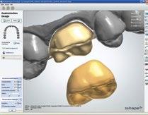 naar uw lab, die de scanresultaten vindt in zijn dental system in de TRIOS