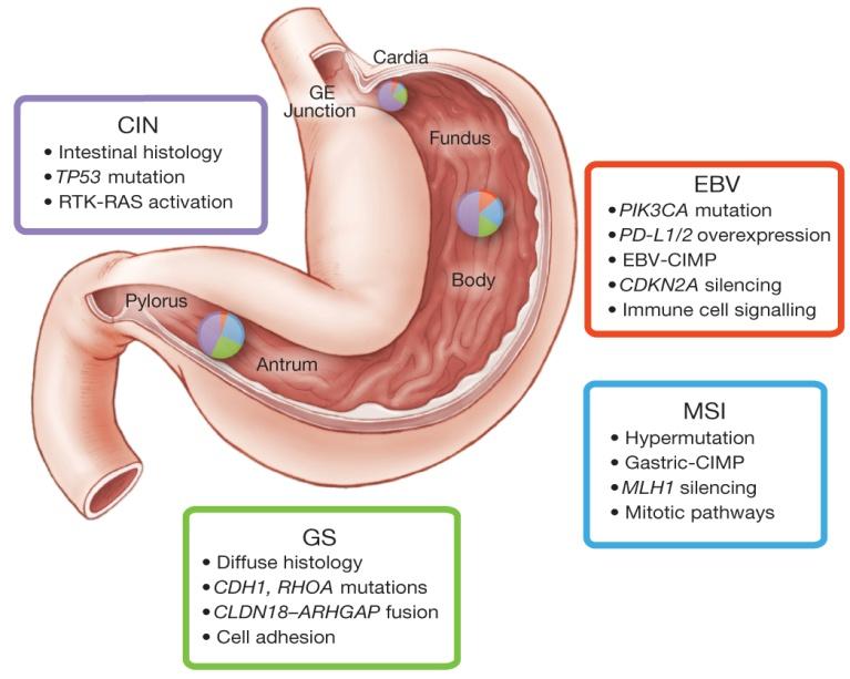 Key features of gastric cancer subtypes.