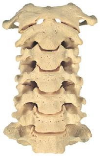 sternocleidomastoideus Lamina superficialis van de fascia colli M. orbicularis oculi (pars orbitalis) M. levator labii superioris en m. levator labii superioris alaeque nasi Mm.