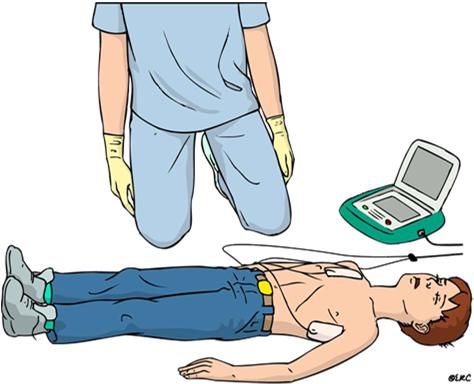 Gebruik AED zoals bij volwassenen Tussen 1 en 8 jaar Bij voorkeur: kinderelektroden