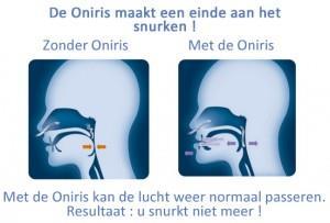 ONIRIS : hoe werkt het? De ONIRIS is een innoverend en gepatenteerd mandibulair repositie apparaat speciaal ontworpen om u maximaal comfort en effectiviteit te bieden.