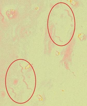 Varkensdiarree: Brachyspira Ziekteverwekker >10 soorten bekend Anaerobische spirocheet Hemolyse