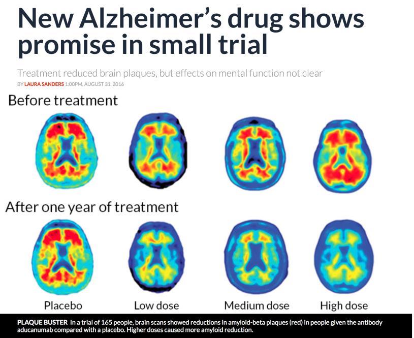 Alzheimer eiwitten Heel veel onderzoek Speelt rol