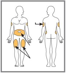 1e Kies de plaats om te injecteren. U kunt injecteren in uw buik, in uw bovenbeen of in de achterkant van uw bovenarm. Om in uw arm te injecteren heeft u de hulp van een ander nodig.