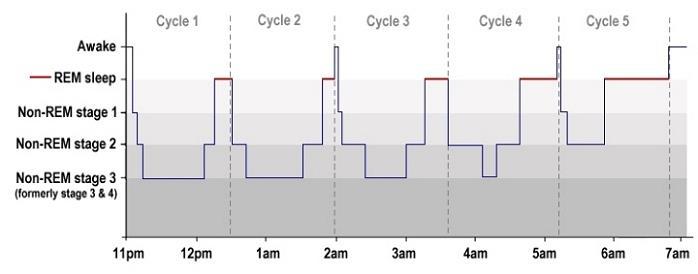 Hypnogram Tijd in bed N1 (1-7%) Totale slaap tijd N2 (45-55%) Slaap efficiëntie (>90%)