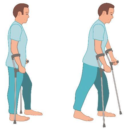 Lopen met een hulpmiddel Belasten lopen met elleboogkrukken Ga goed rechtop staan met in elke hand een kruk en steun op beide benen. U steunt op het aangedane been zoveel de pijn toelaat.
