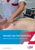 Informatiebrochure patiënten. Herstel van het hartritme. Elektrische cardioversie bij voorkamerfibrillatie/-flutter