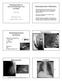 Radiodiagnostiek (Wikipedia) Rontgenfoto s. Radiodiagnostische technieken. Longfoto. Mammografie