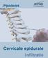 Cervicale epidurale infiltratie